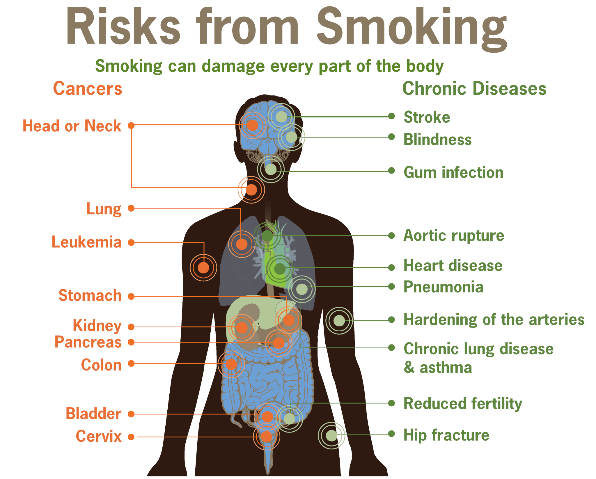 Smoking can damage every part of the body